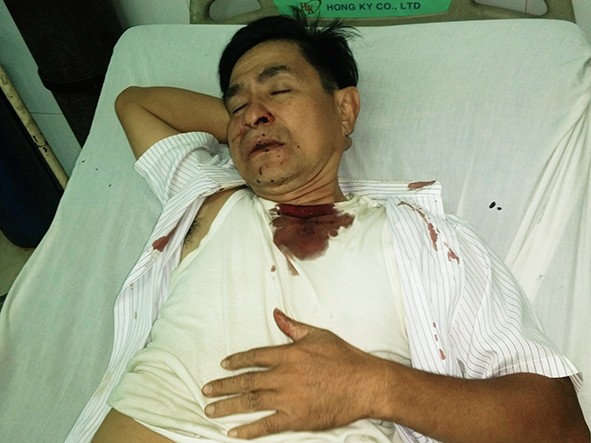 Mennoniittipastori Nguyen Hong Quang on joutunut useita kertoja viranomaisten värväämien hyökkääjien pahoinpitelemäksi. Kuva: Marttyyrien Ääni
